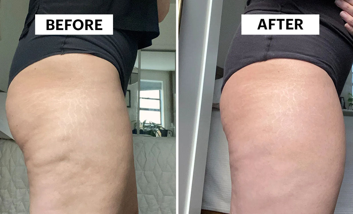 Electric Cupping Massager