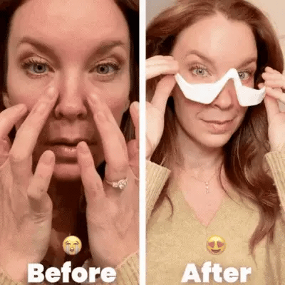 Facial Lifting Beauty Eye Pad