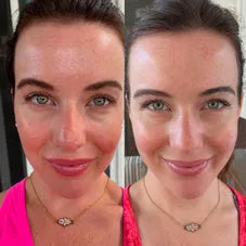 Facial Lifting Beauty Eye Pad