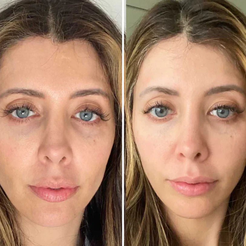 Facial Lifting Beauty Eye Pad